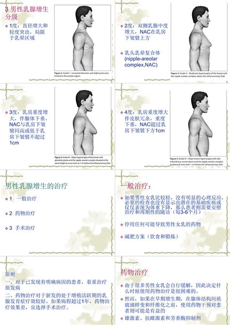 男人胸|男性乳房增大（男性乳房发育症）